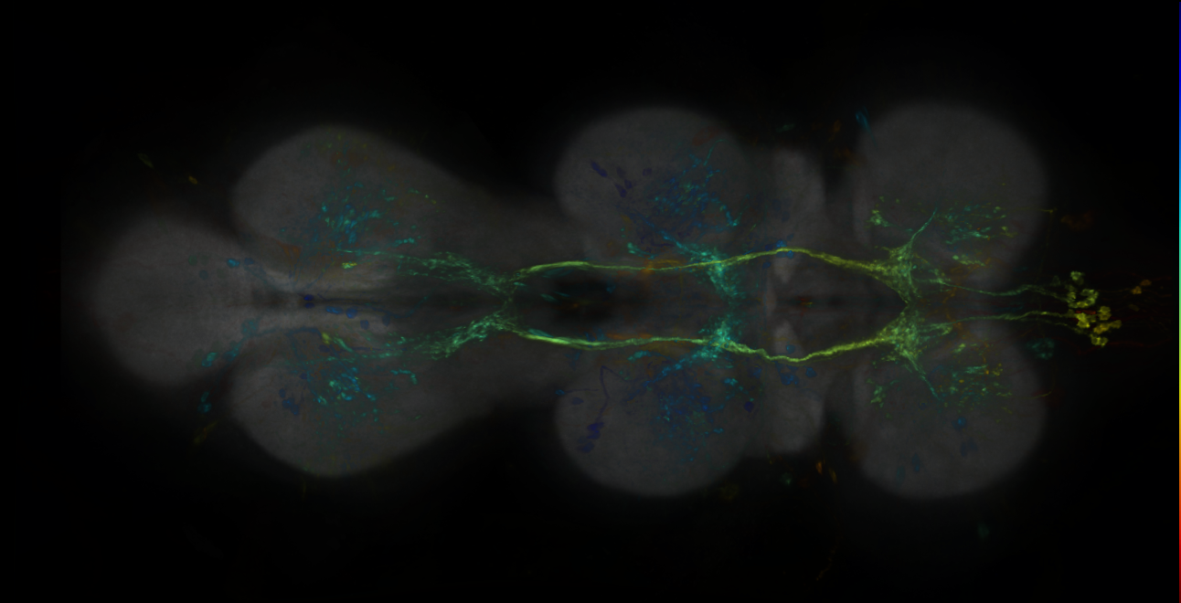 P{GMR14G10-lexA} expression pattern