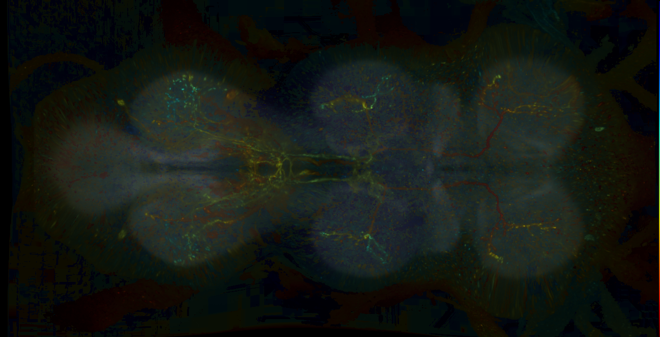 P{GMR15C11-lexA} expression pattern