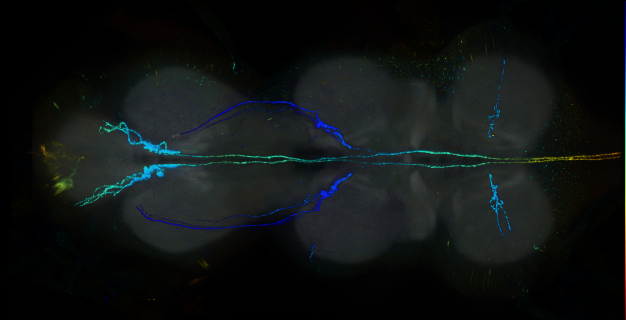P{GMR17C02-lexA} expression pattern