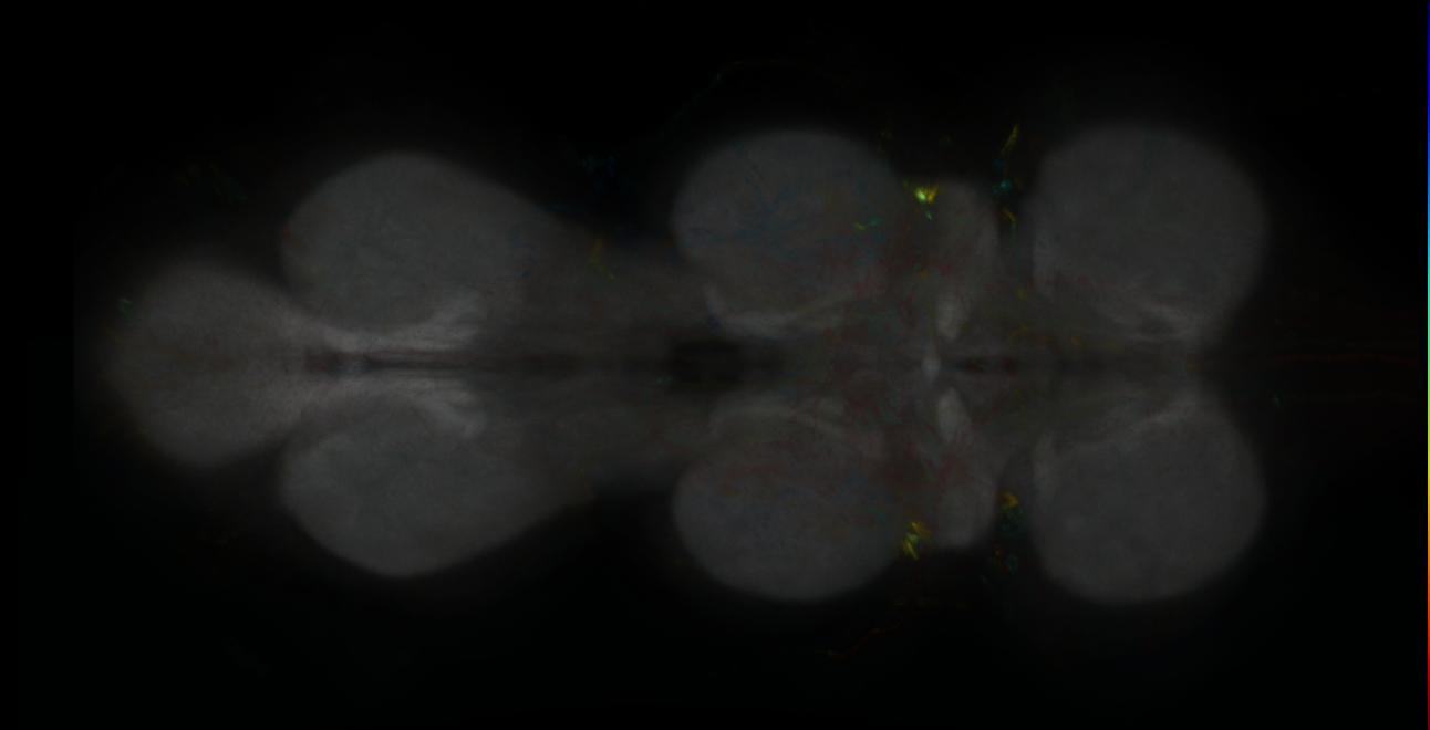P{GMR17C11-lexA} expression pattern