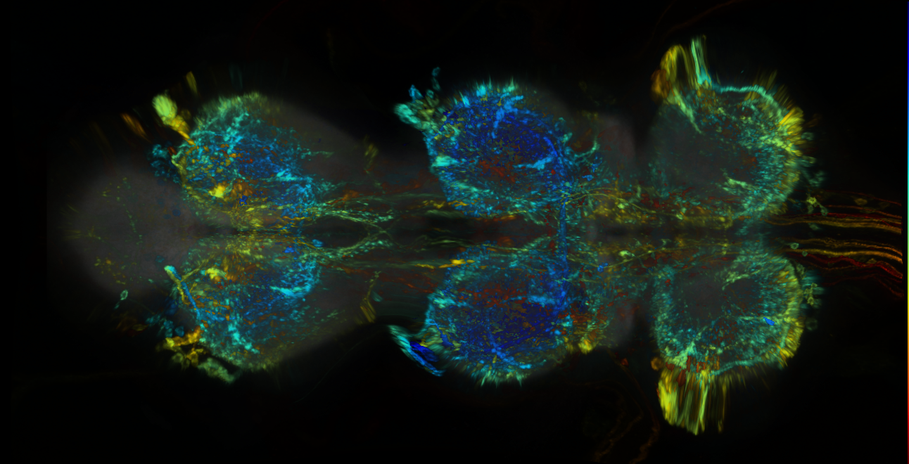 P{GMR17D06-lexA} expression pattern