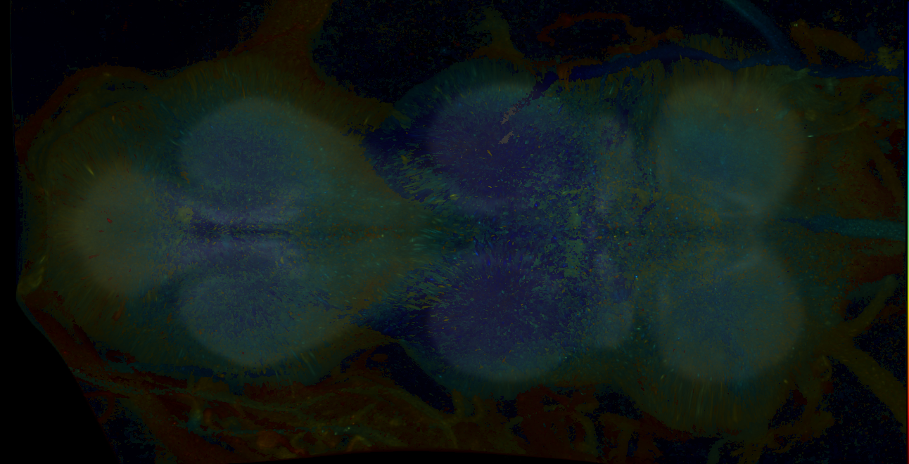 P{GMR17F10-lexA} expression pattern