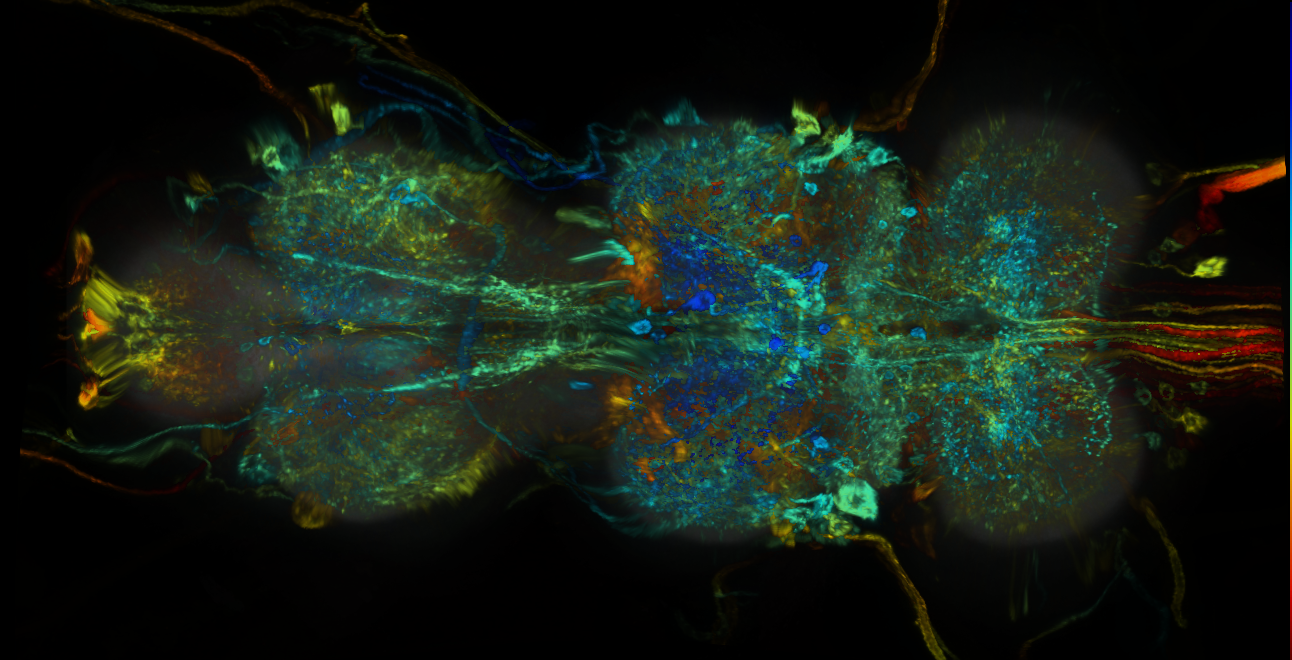 P{GMR18A08-lexA} expression pattern
