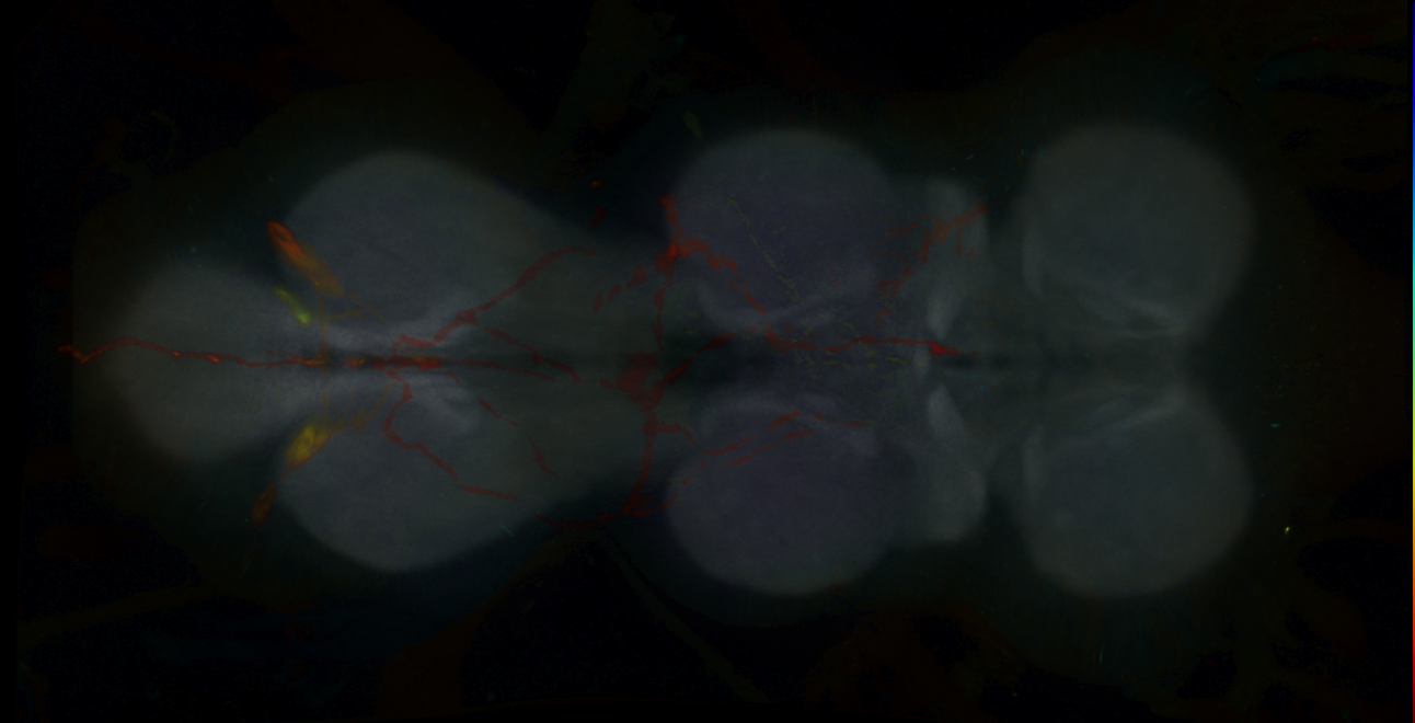 P{GMR18D09-lexA} expression pattern