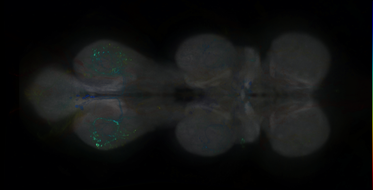 P{GMR18G01-lexA} expression pattern
