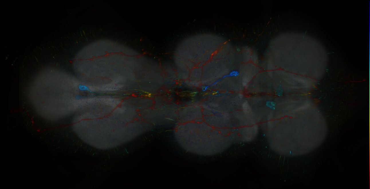 P{GMR19A11-lexA} expression pattern