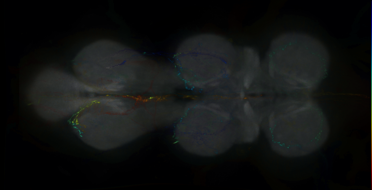 P{GMR19F06-lexA} expression pattern