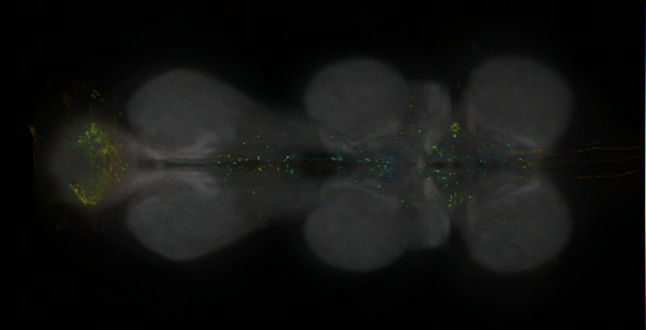 P{GMR19F11-lexA} expression pattern