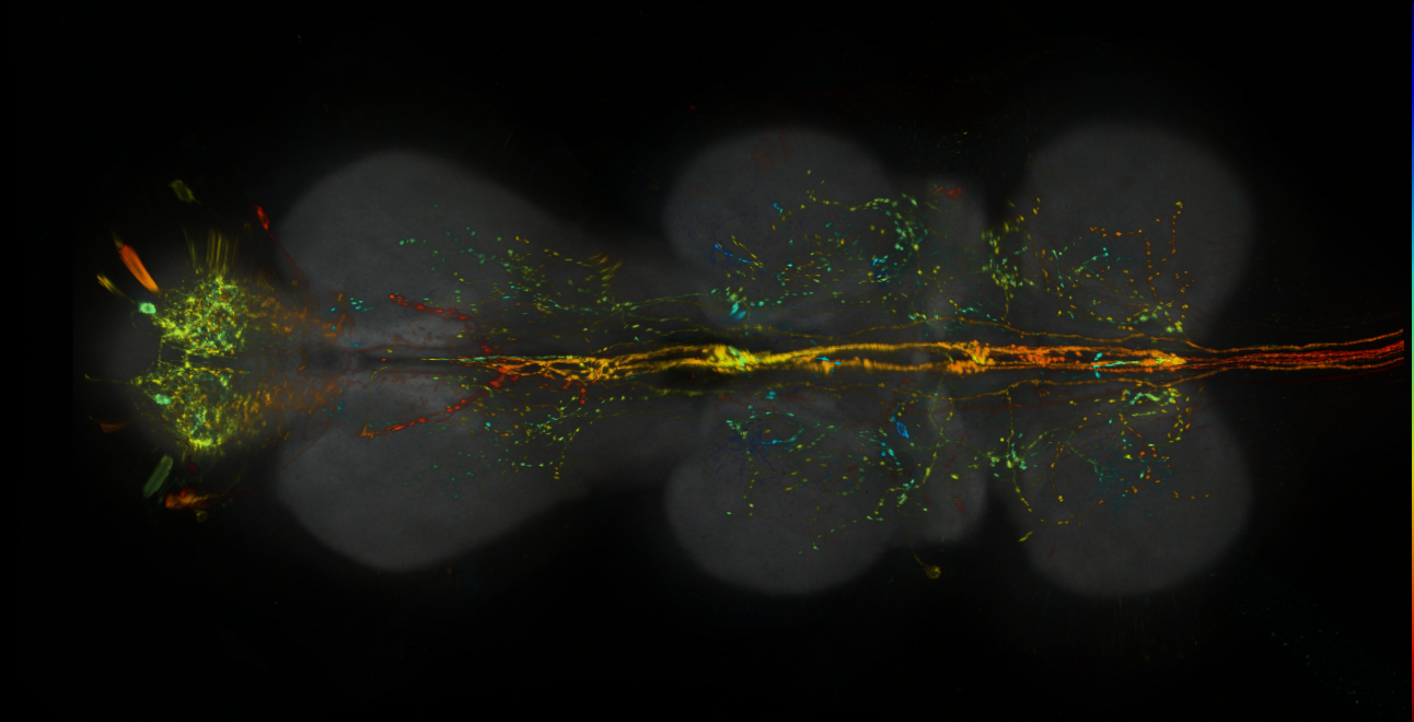 P{GMR22D06-lexA} expression pattern