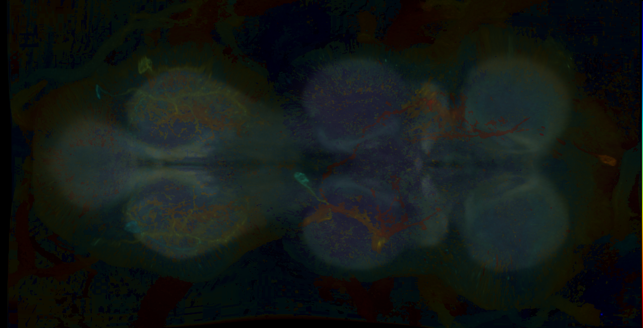 P{GMR22D09-lexA} expression pattern
