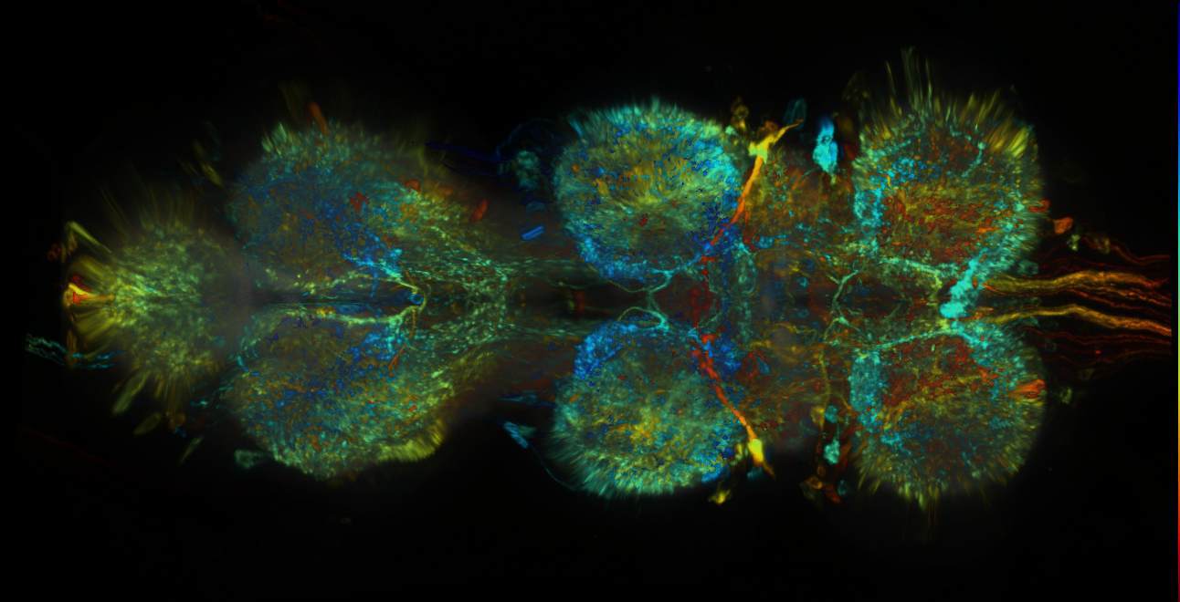 P{GMR22G02-lexA} expression pattern
