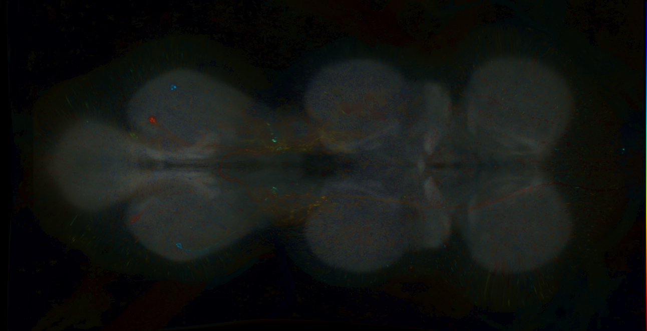 P{GMR23B11-lexA} expression pattern