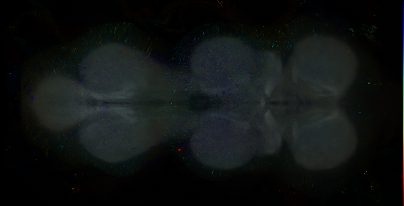 P{GMR23C11-lexA} expression pattern