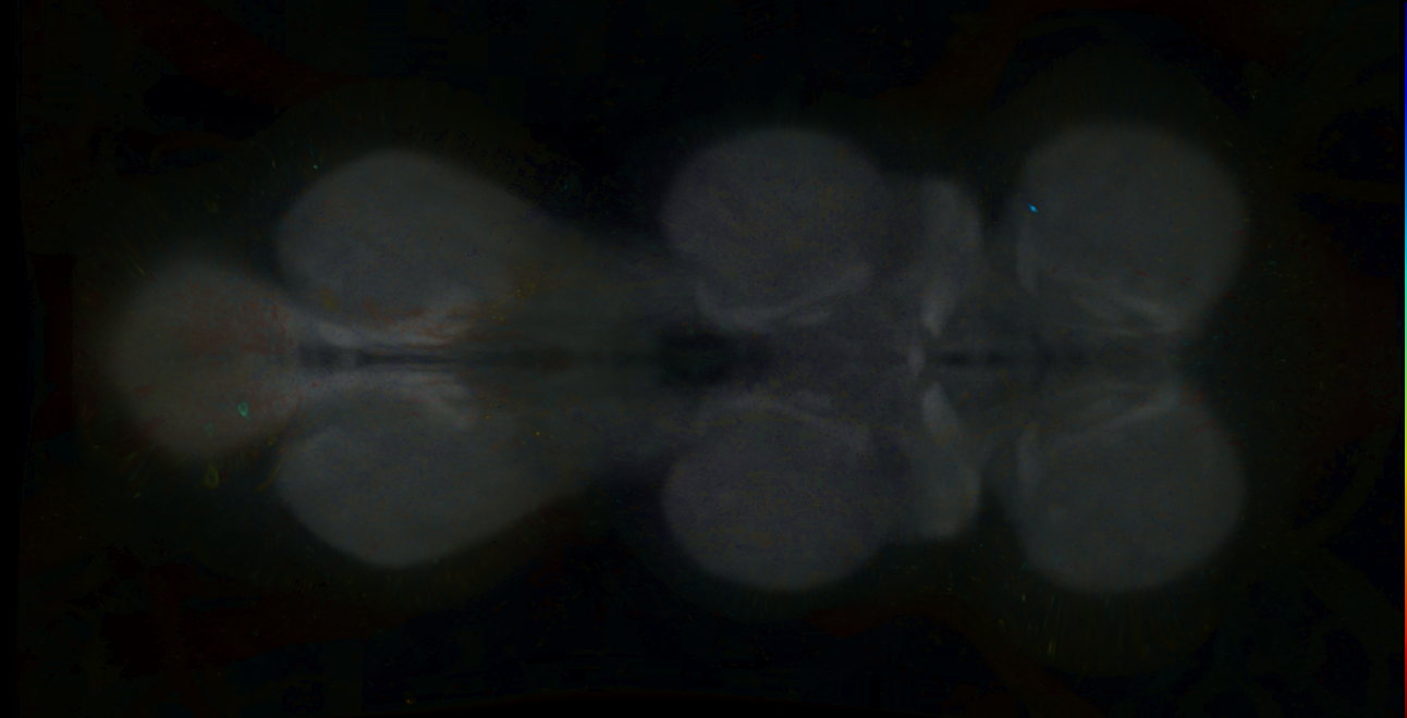 P{GMR25C04-lexA} expression pattern