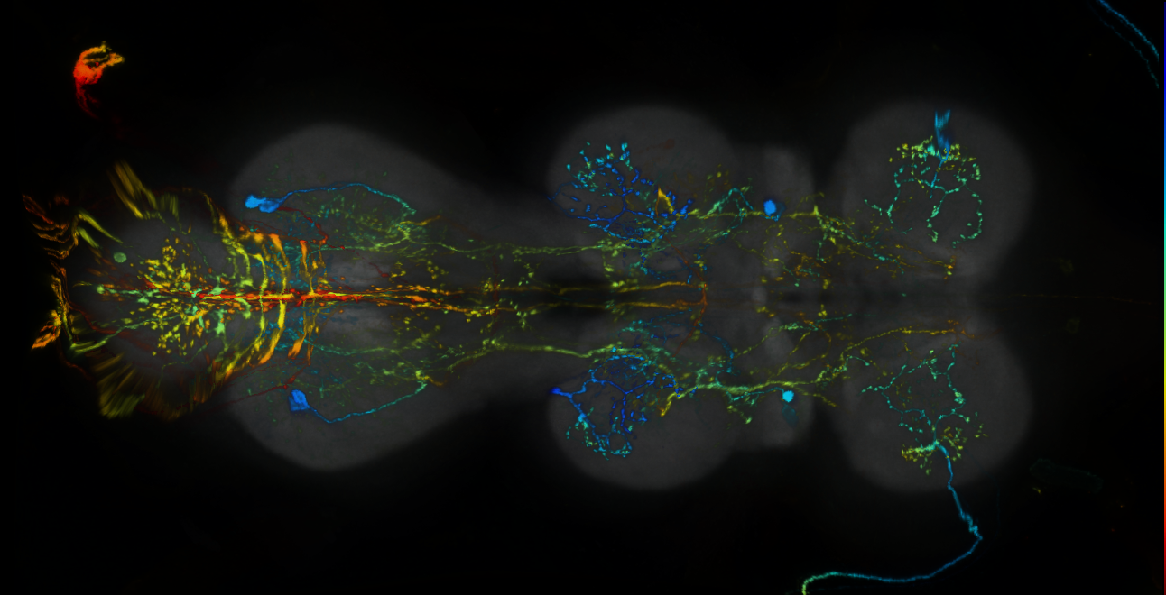 P{GMR25E04-lexA} expression pattern