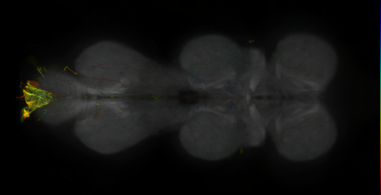 P{GMR25F07-lexA} expression pattern