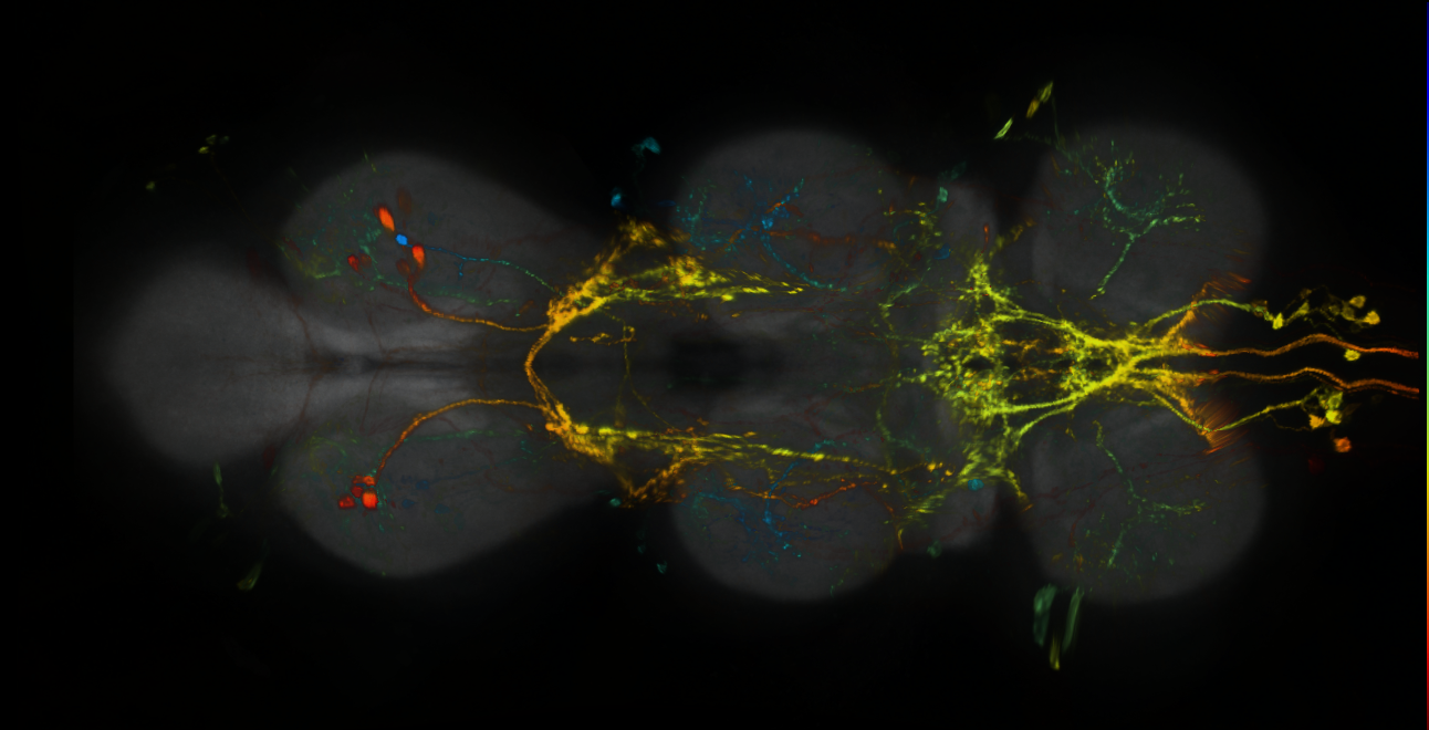 P{GMR33H07-lexA} expression pattern