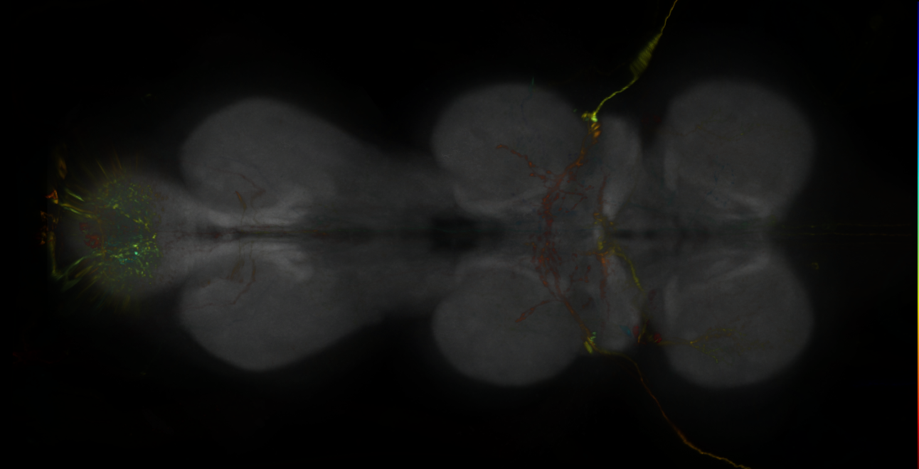P{GMR35B12-lexA} expression pattern