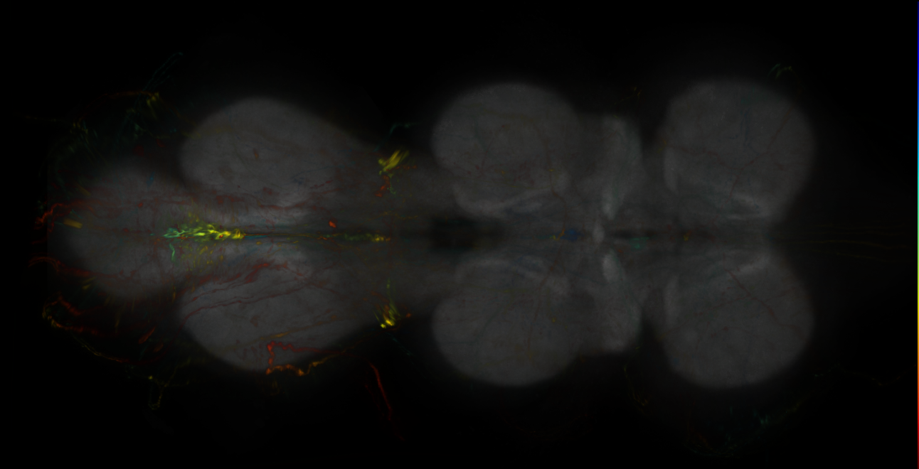 P{GMR39E10-lexA} expression pattern