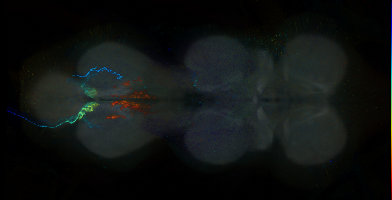 P{GMR40C04-lexA} expression pattern
