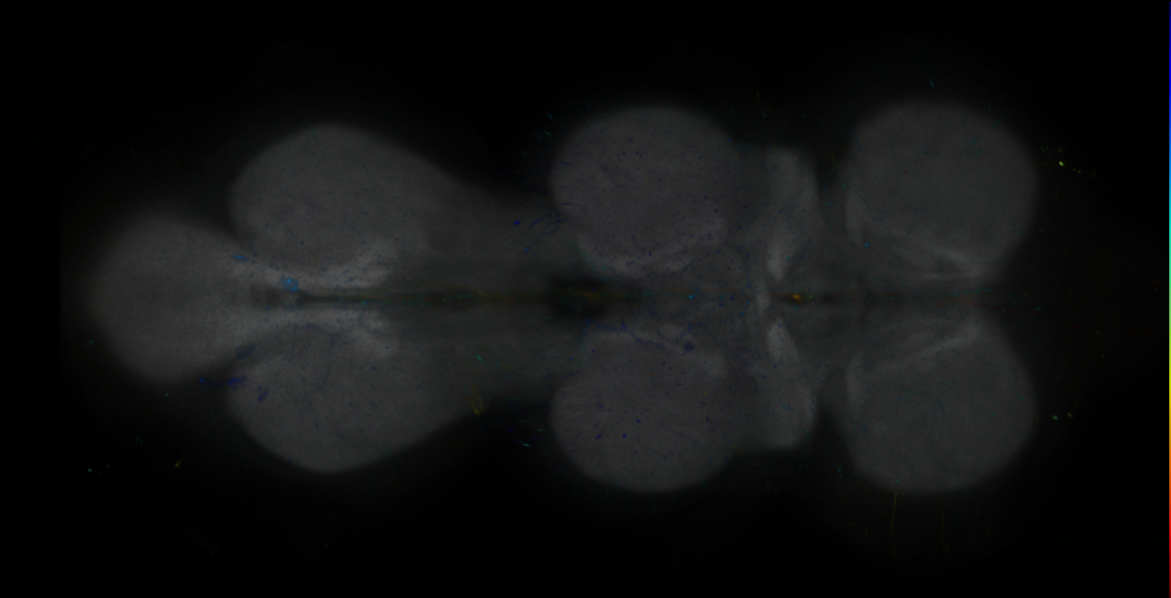 P{GMR41G06-lexA} expression pattern