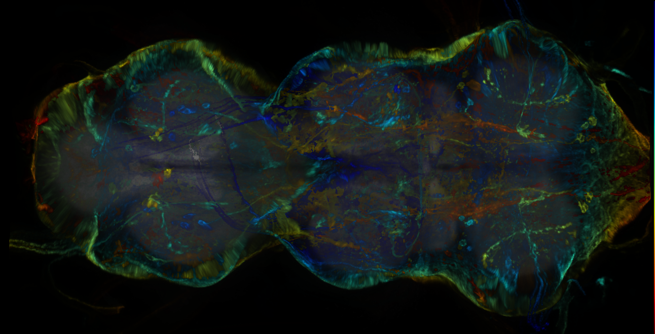P{GMR44H08-lexA} expression pattern