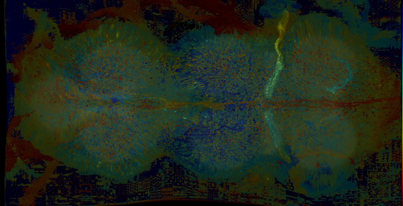 P{GMR45E03-lexA} expression pattern