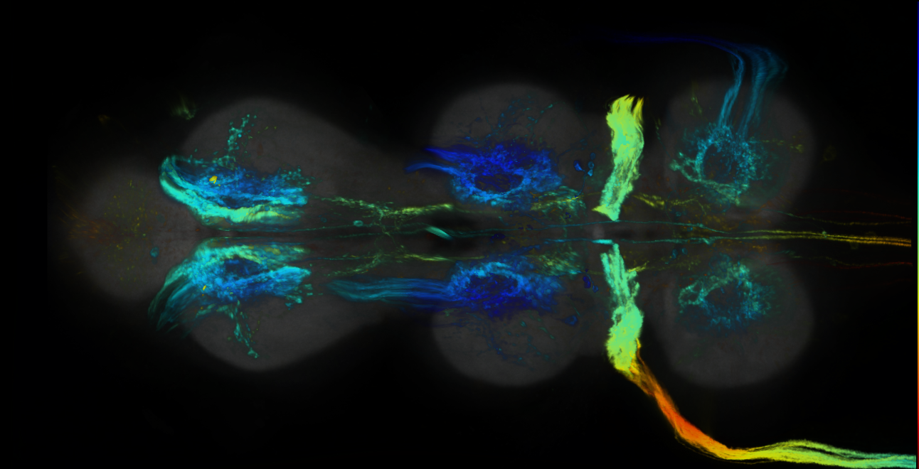 P{GMR45F05-lexA} expression pattern