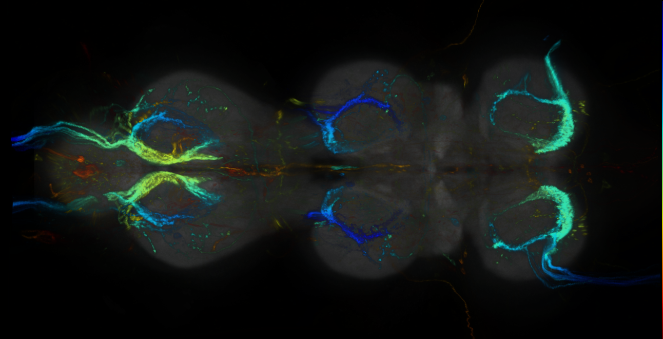 P{GMR47C08-lexA} expression pattern