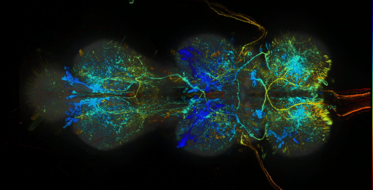 P{GMR49A07-lexA} expression pattern