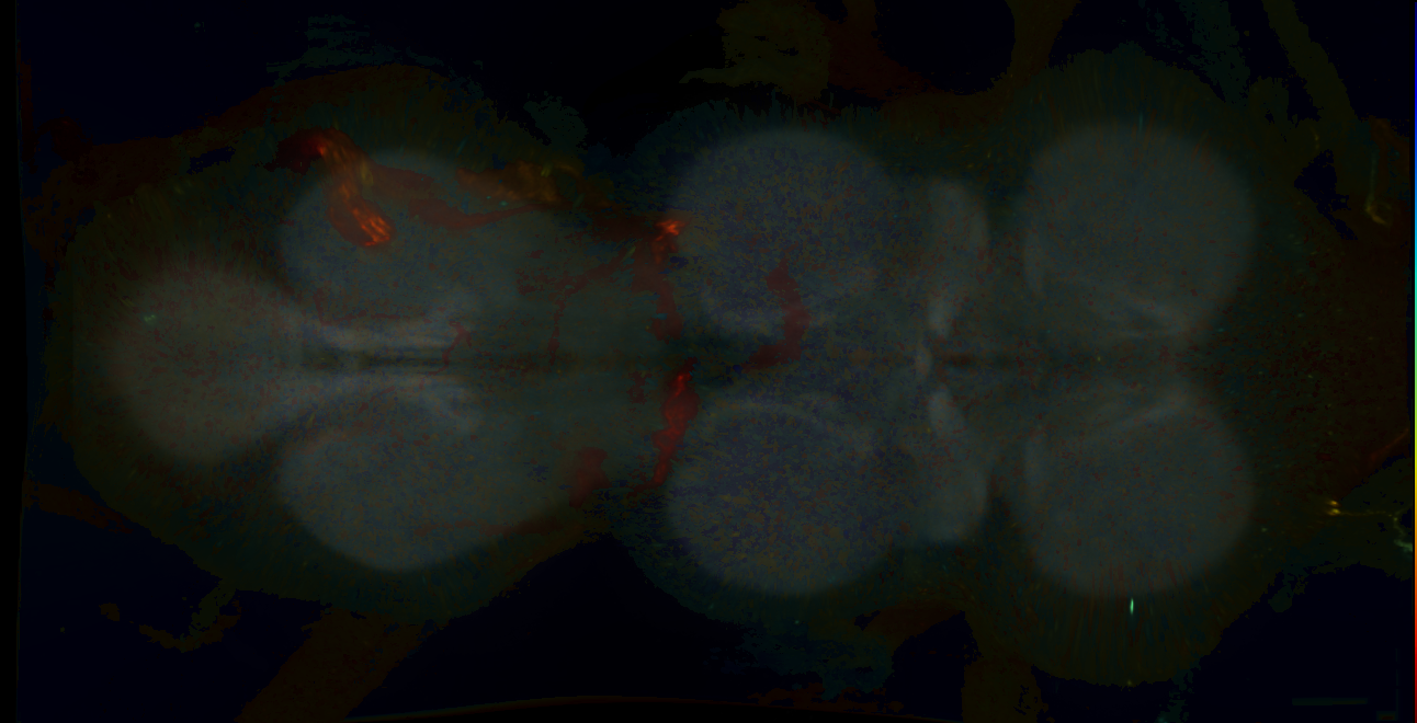 P{GMR54B01-lexA} expression pattern