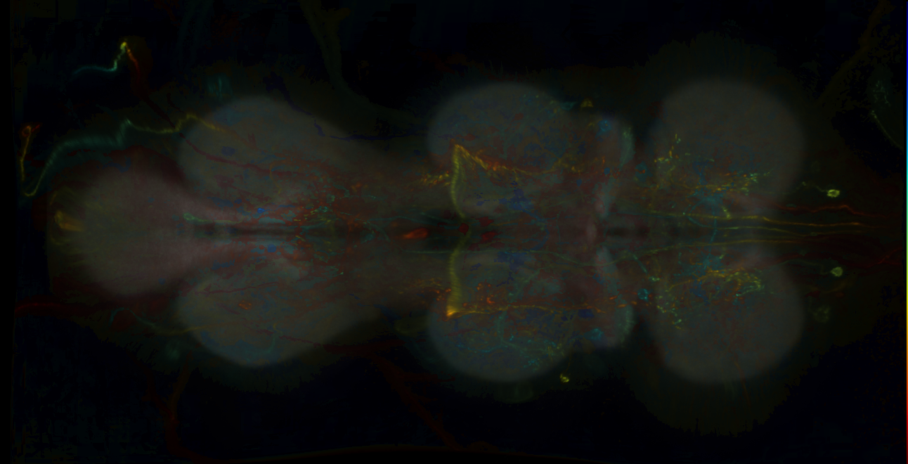 P{GMR55C04-lexA} expression pattern
