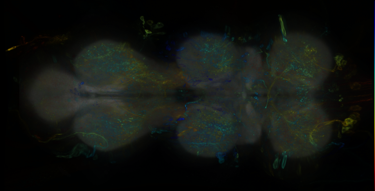 P{GMR57A01-lexA} expression pattern