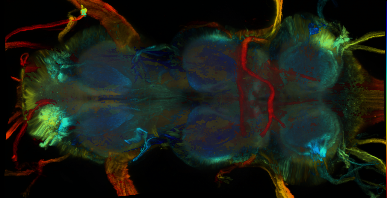 P{GMR57C10-lexA} expression pattern