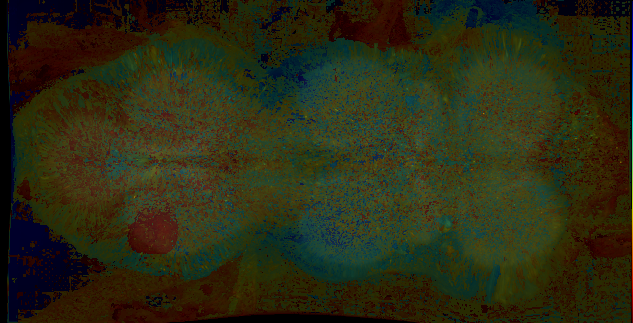 P{GMR57D01-lexA} expression pattern