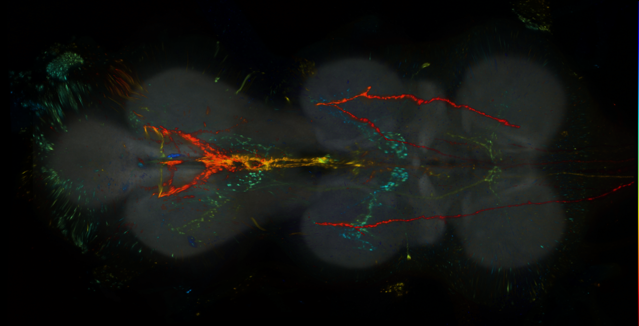 P{GMR57F07-lexA} expression pattern