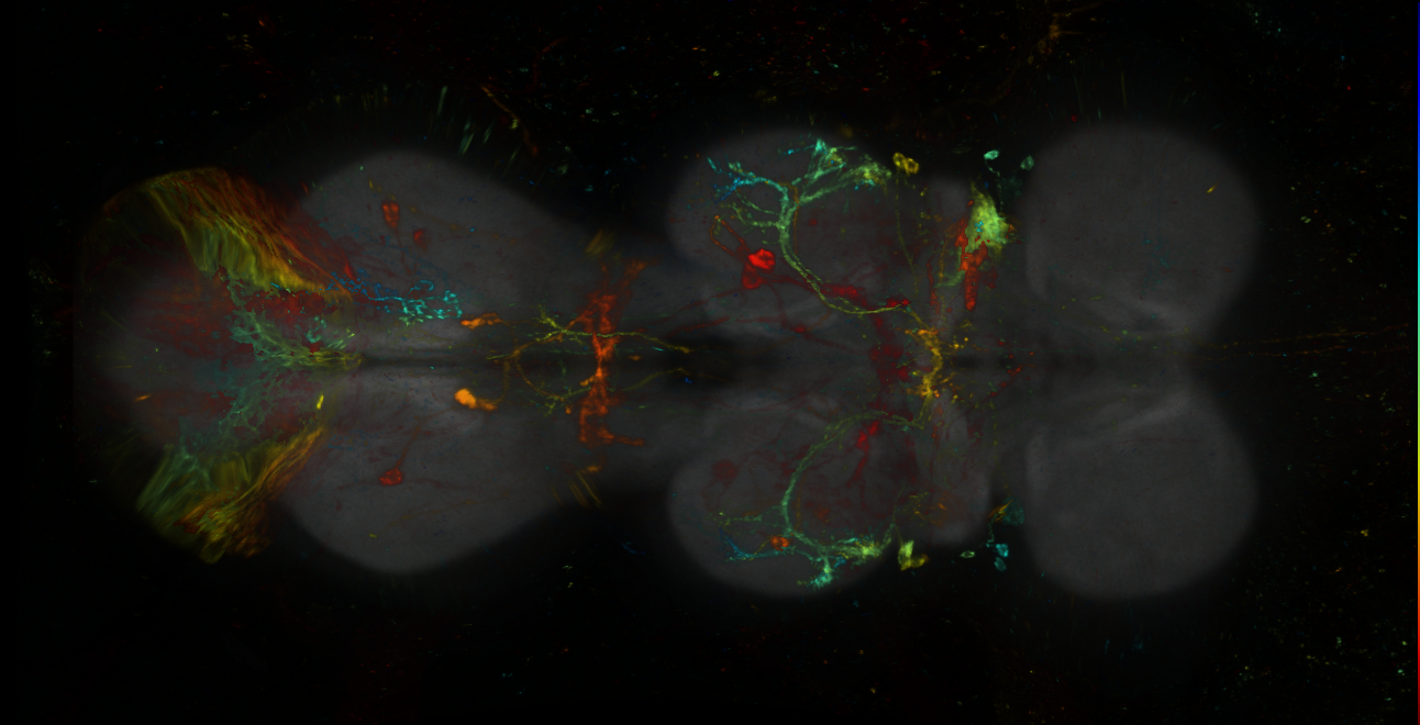 P{GMR59A05-lexA} expression pattern