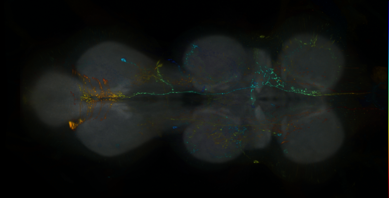 P{GMR59B10-lexA} expression pattern