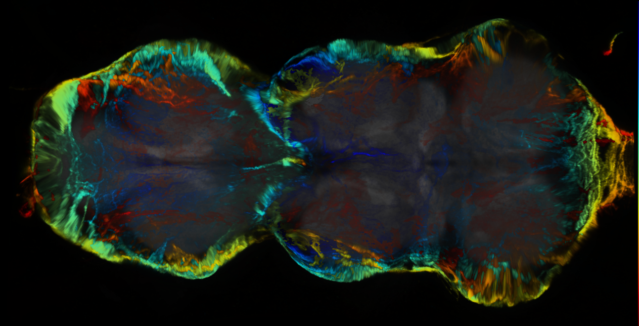 P{GMR60A03-lexA} expression pattern
