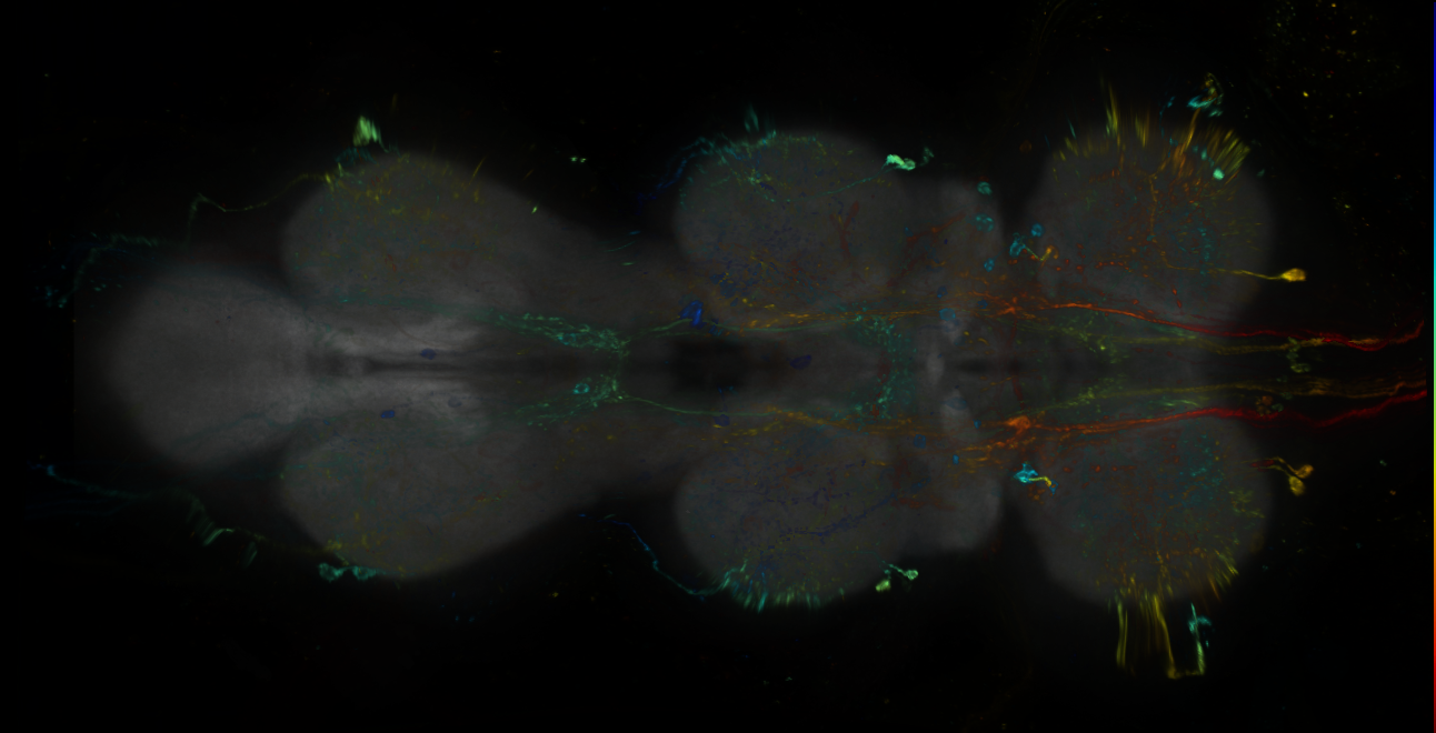 P{GMR60A10-lexA} expression pattern