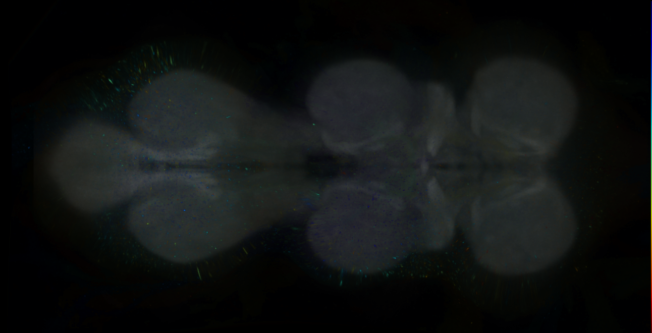 P{GMR60H03-lexA} expression pattern