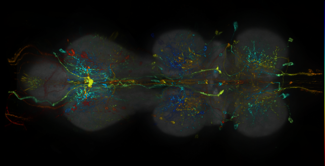 P{GMR64F08-lexA} expression pattern