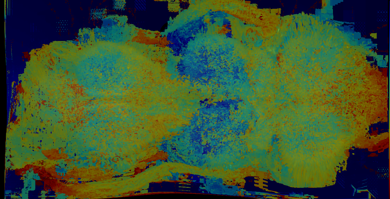 P{GMR69C02-lexA} expression pattern