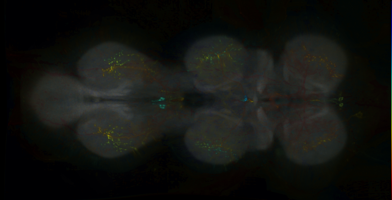P{GMR70B03-lexA} expression pattern