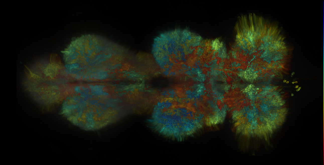 P{GMR70B04-lexA} expression pattern