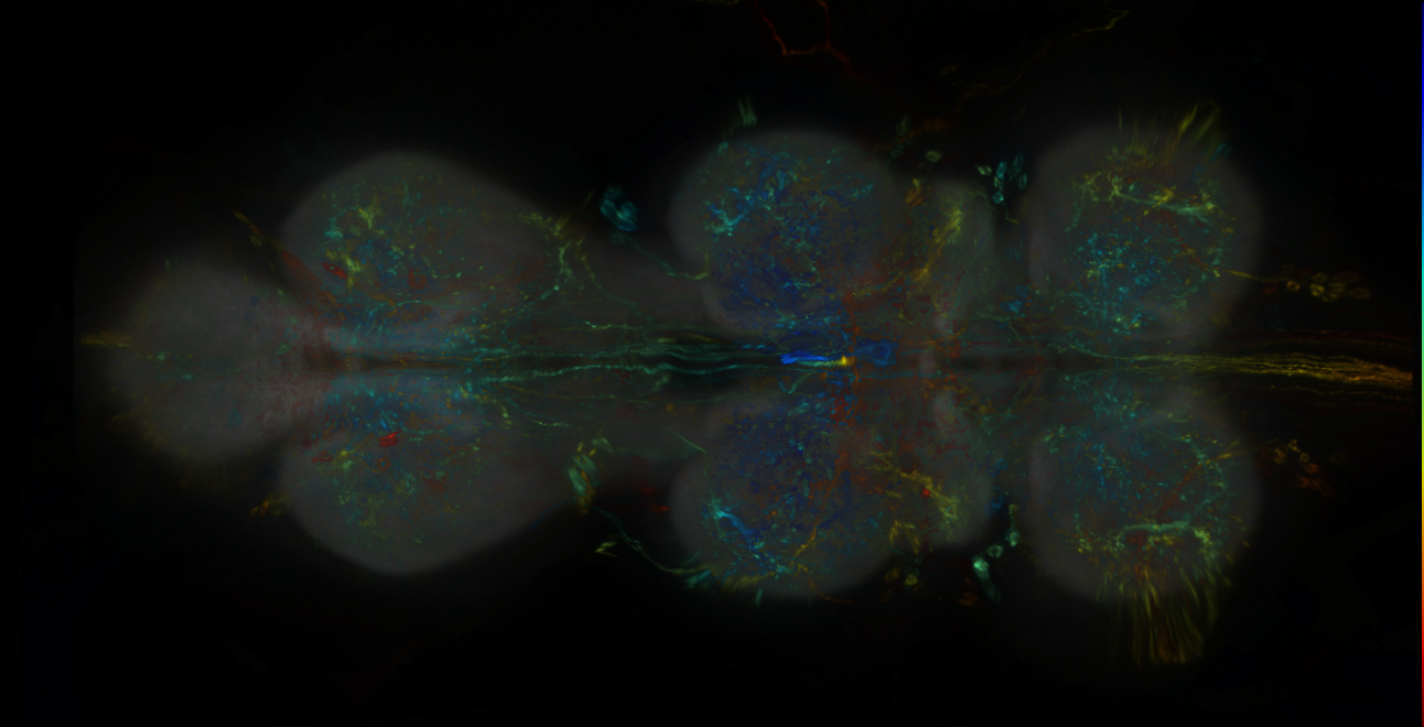 P{GMR70F10-lexA} expression pattern