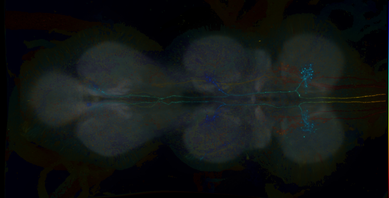 P{GMR70H11-lexA} expression pattern