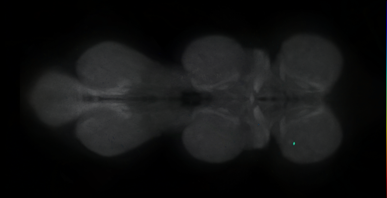P{GMR71C11-lexA} expression pattern