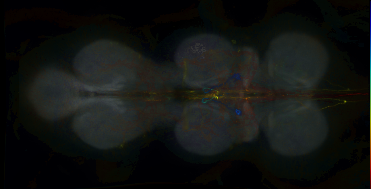 P{GMR72B07-lexA} expression pattern