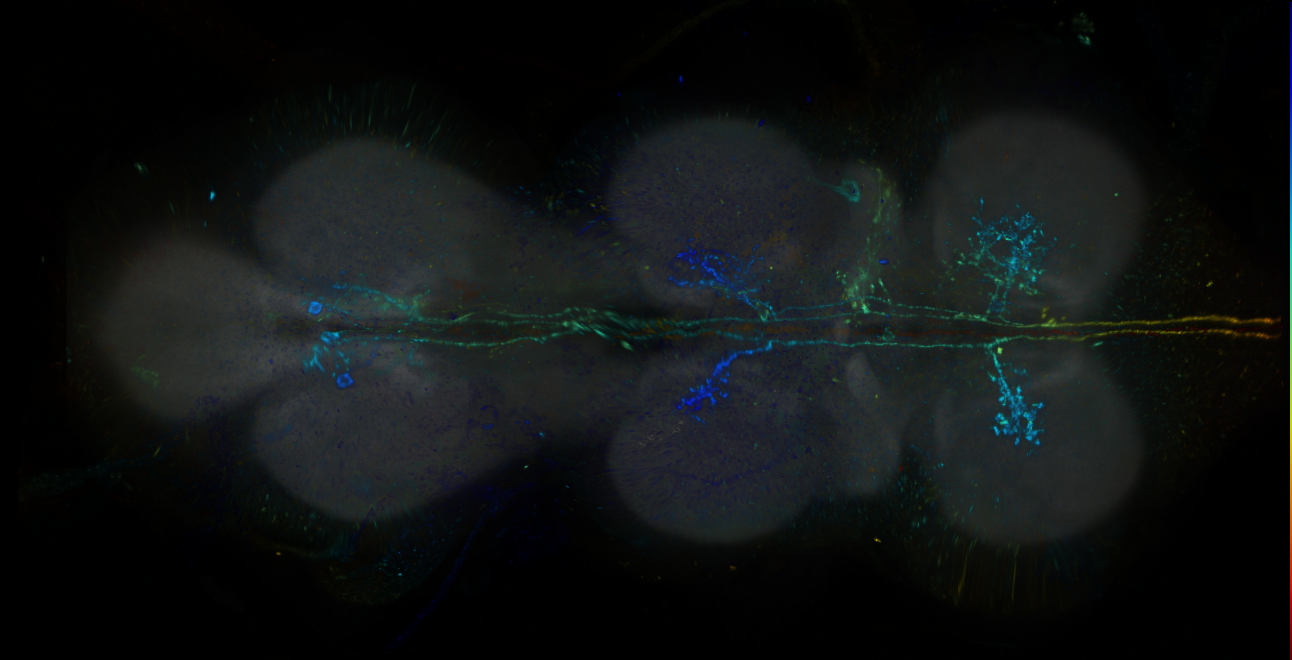 P{GMR72F03-lexA} expression pattern